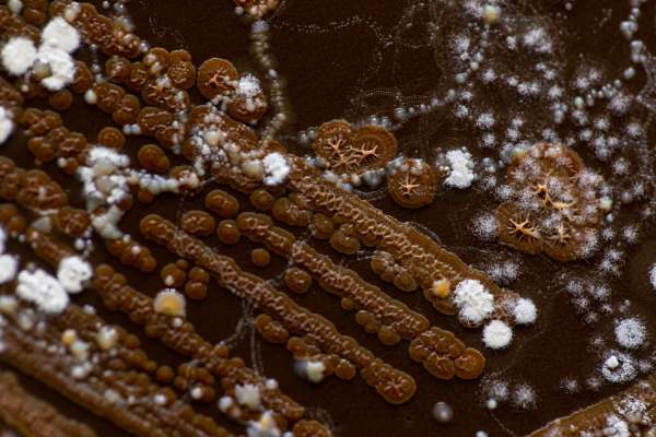 Soil health and microbes