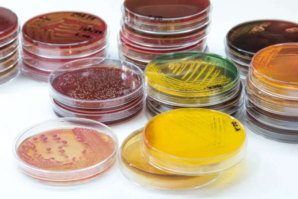 Are you sterile? Using sterile technique to tissue culture plants